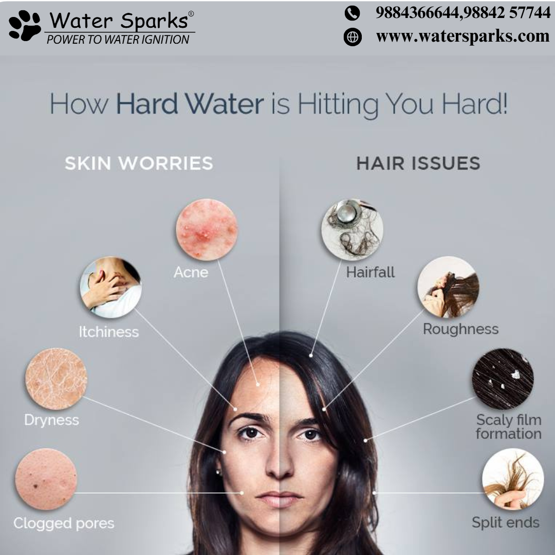 hard water