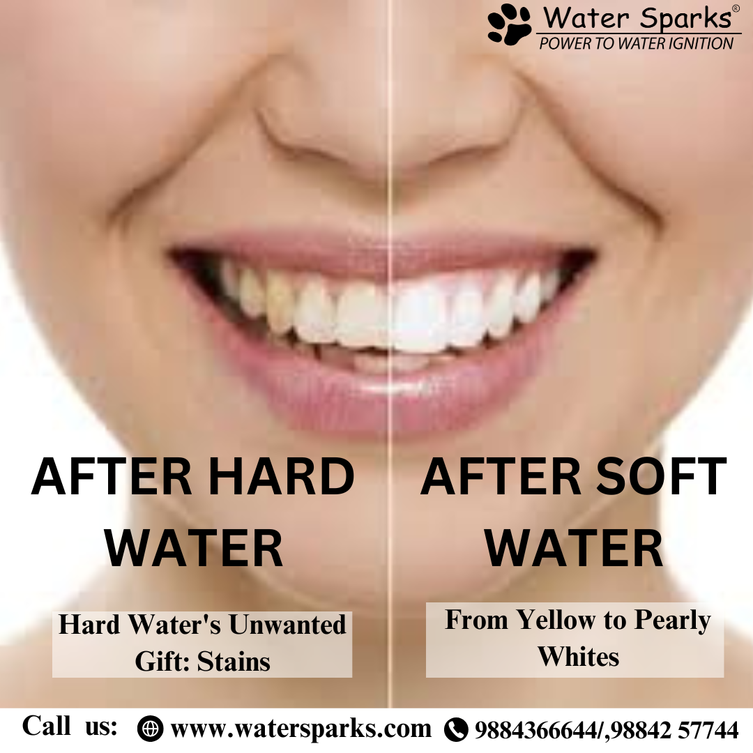 Hard Water Stains in Teeth