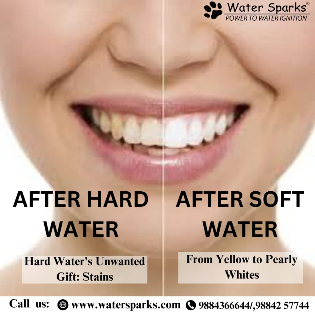 before and after of teeth using hard water and soft water