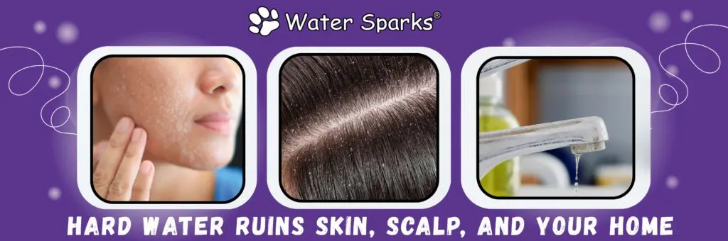 hard water ruins skin,scalp and whole house