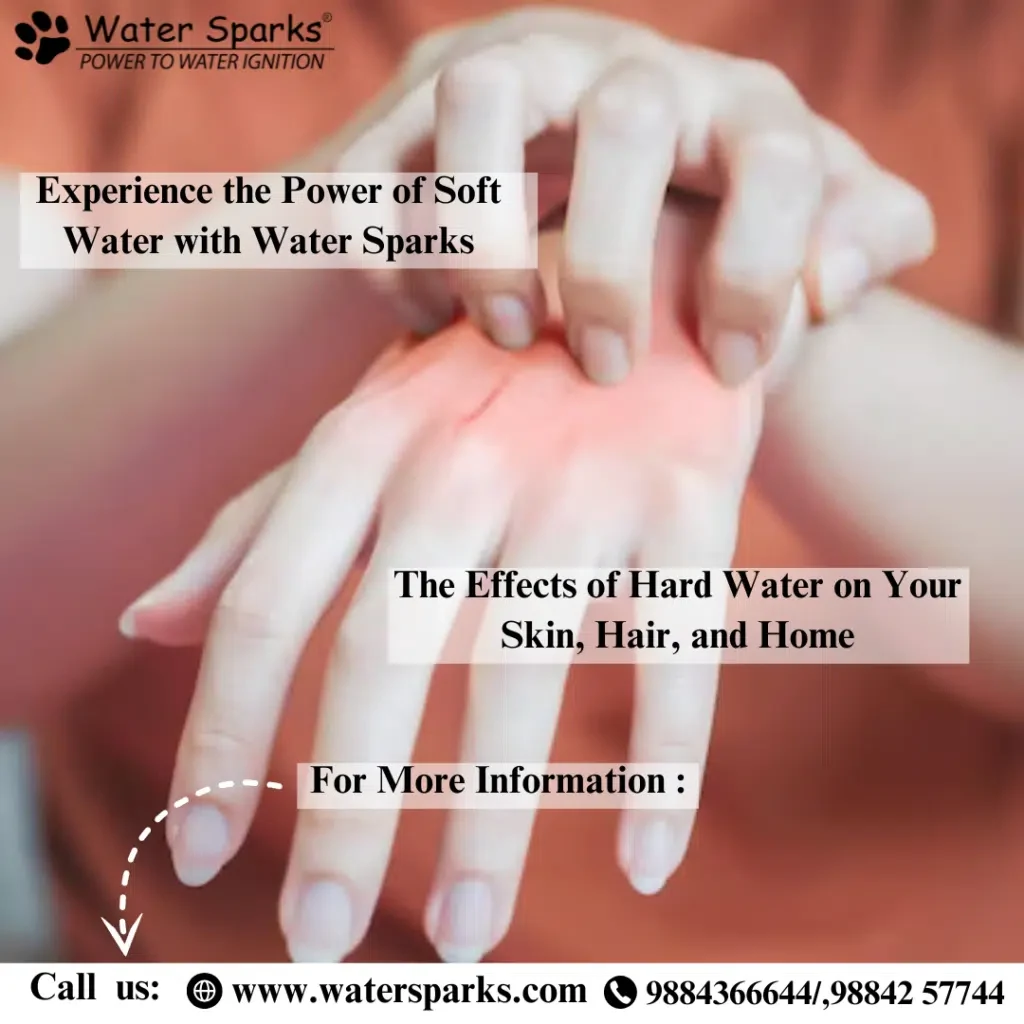 hard water makes hand skin irritation