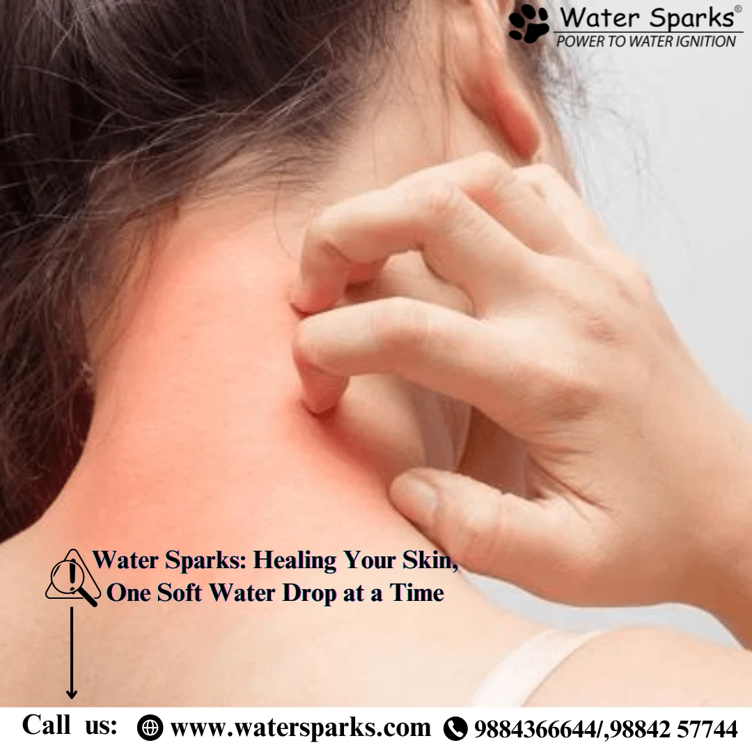 hard water causes girl skin irritation