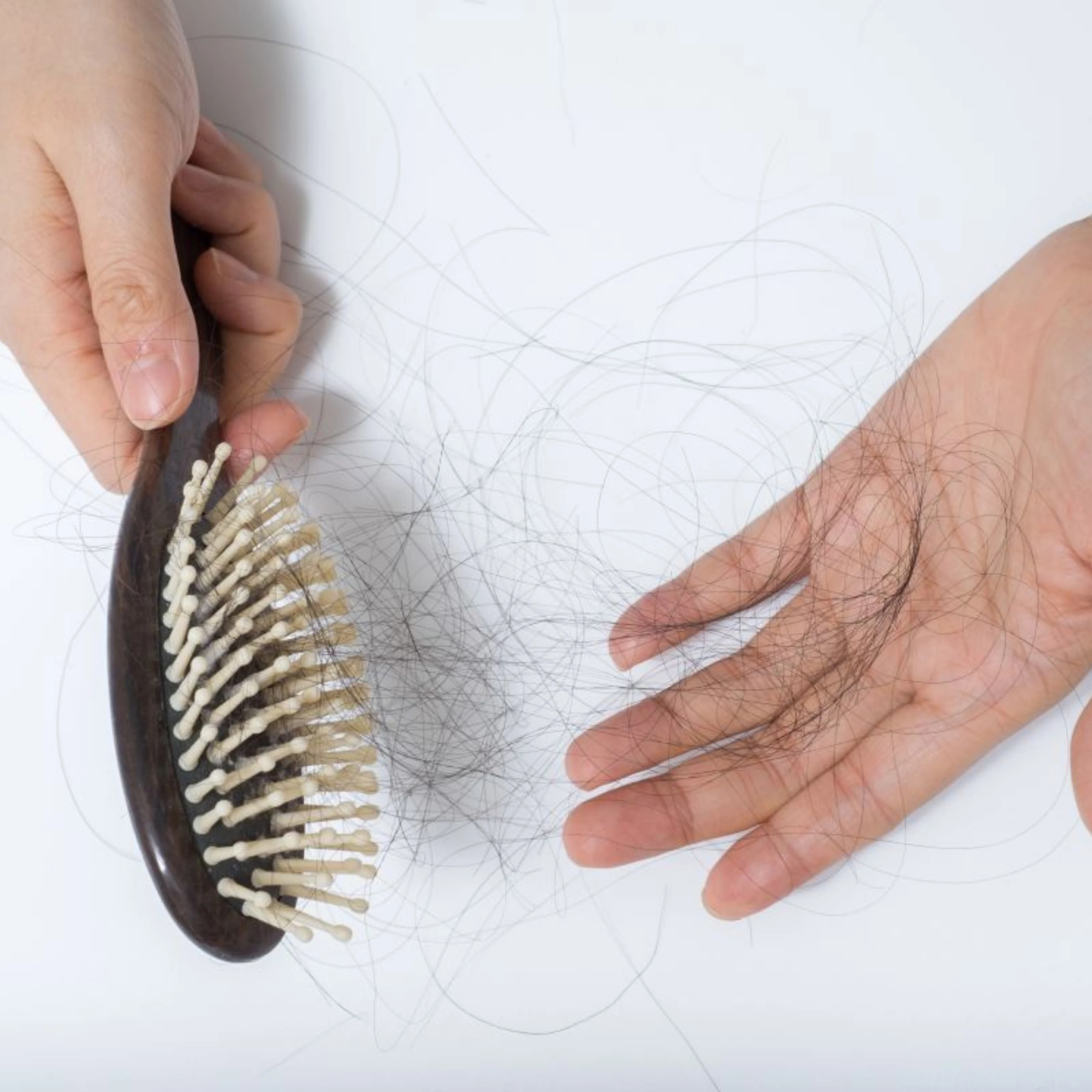 do you know hair fall problem